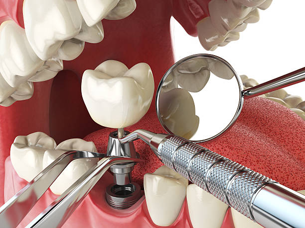 Best Orthodontic Emergency Dentist in Tignall, GA